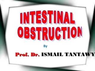 By
Prof. Dr.Prof. Dr. ISMAIL TANTAWYISMAIL TANTAWY
 