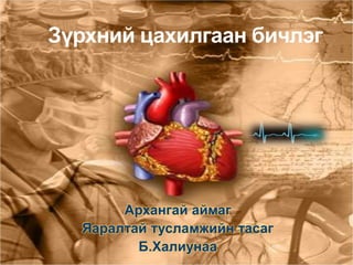 Зүрхний цахилгаан бичлэг
Архангай аймаг
Яаралтай тусламжийн тасаг
Б.Халиунаа
 