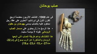 ‫يوحانان‬ ‫صلب‬
‫عام‬ ‫في‬1968‫ترجع‬ ‫معضمة‬ ‫االثريون‬ ‫اكتشف‬ ،
‫اورشليم‬ ‫في‬ ‫االول‬ ‫للقرن‬“‫رجل‬ ‫عظا‬ ‫على‬ ‫تحتوي‬
‫يسمى‬ ‫بالصلب‬ ‫عليه‬ ‫محكوم‬‫حقو‬ ‫بن‬ ‫يهوحنان‬‫ل‬
•‫على‬ ‫يحتوي‬ ‫زال‬ ‫ما‬ ‫الرسغ‬ ‫هذا‬‫الصلب‬ ‫مسمار‬
‫الروماني‬‫طوله‬7‫سليما‬ ‫بوصة‬.
‫اتبعها‬ ‫التي‬ ‫الصلب‬ ‫طريقة‬ ‫يدعم‬ ‫االكتشاف‬ ‫هذا‬
‫في‬ ‫يسوع‬ ‫الرب‬ ‫عن‬ ‫والمذكورة‬ ‫الرومان‬(‫مز‬22،
‫مت‬27‫مر‬ ،15‫لو‬ ،23‫يو‬ ،19)
 