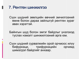 7. Рентген шинжилгээ
Сүүн шүдний зөөлцийн өвчний эмчилгээний
өмнө болон дараа зайлшгүй рентген зураг
авах хэрэгтэй.
Байнгын шүд болон эмгэг байдлыг үнэлэхэд
туслах нэмэлт шинжилгээний арга юм.
Сүүн шүдний сурвалжийн орой орчмоос илүү
бифуркаци, трифуркацийн орчимд
шимэгдэл байдгийг анхаар.
 