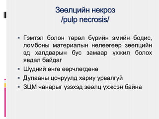 Зөөлцийн некроз
/pulp necrosis/
 Гэмтэл болон төрөл бүрийн эмийн бодис,
ломбоны материалын нөлөөгөөр зөөлцийн
эд халдварын бус замаар үхжил болох
явдал байдаг
 Шүдний өнгө өөрчлөгдөнө
 Дулааны цочруулд хариу урвалгүй
 ЗЦМ чанарыг үзэхэд зөөлц үхжсэн байна
 