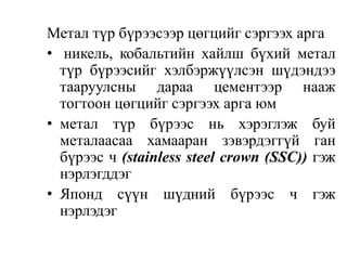 Метал түр бүрээсээр цөгцийг сэргээх арга
• никель, кобальтийн хайлш бүхий метал
түр бүрээсийг хэлбэржүүлсэн шүдэндээ
тааруулсны дараа цементээр нааж
тогтоон цөгцийг сэргээх арга юм
• метал түр бүрээс нь хэрэглэж буй
металаасаа хамааран зэвэрдэггүй ган
бүрээс ч (stainless steel crown (SSC)) гэж
нэрлэгддэг
• Японд сүүн шүдний бүрээс ч гэж
нэрлэдэг
 