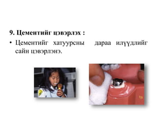 9. Цементийг цэвэрлэх :
• Цементийг хатуурсны дараа илүүдлийг
сайн цэвэрлэнэ.
 