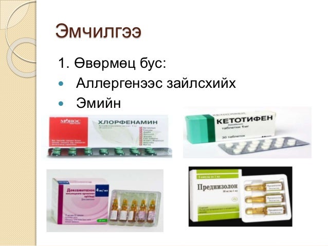 Хамрын харшил
