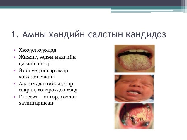 Хожгор үлд