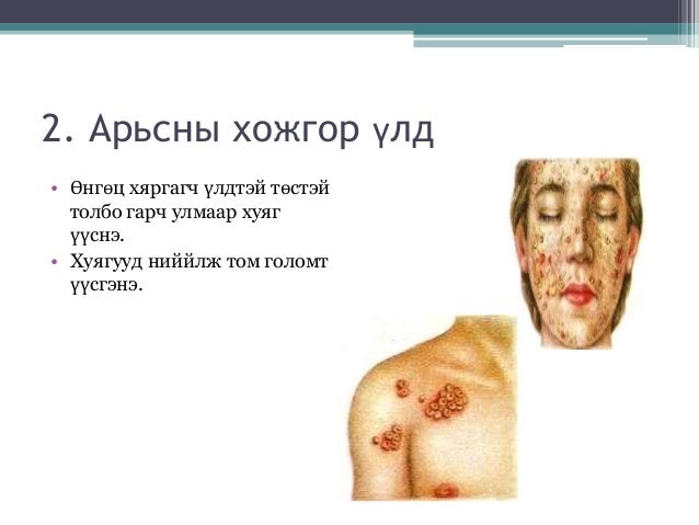 Хожгор үлд