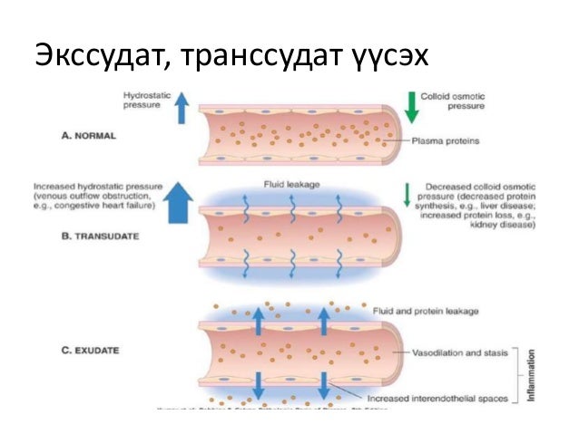 Шүүдэст шингэнд Ривальтын сорил тавих
