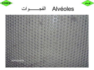 ‫الفجــــــــوات‬ Alvéoles
‫كوسام‬COSEM
 