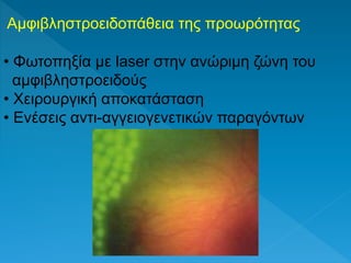 Αμφιβληστροειδοπάθεια της προωρότητας
• Φωτοπηξία με laser στην ανώριμη ζώνη του
αμφιβληστροειδούς
• Χειρουργική αποκατάσταση
• Ενέσεις αντι-αγγειογενετικών παραγόντων
 