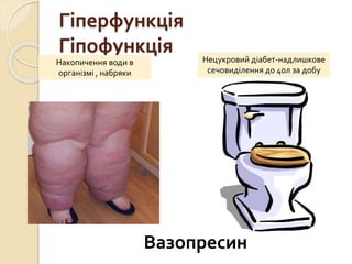 Гіперфункція
Гіпофункція
Накопичення води в
організмі , набряки
Нецукровий діабет-надлишкове
сечовиділення до 40л за добу
Вазопресин
 