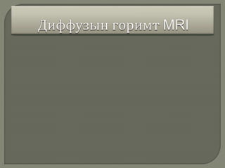 соронзон резонаст томографи