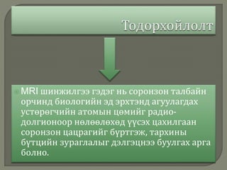  MRI шинжилгээ гэдэг нь соронзон талбайн
орчинд биологийн эд эрхтэнд агуулагдах
устөрөгчийн атомын цөмийг радио-
долгионоор нөлөөлөхөд үүсэх цахилгаан
соронзон цацрагийг бүртгэж, тархины
бүтцийн зураглалыг дэлгэцнээ буулгах арга
болно.
 