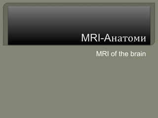MRI of the brain
 