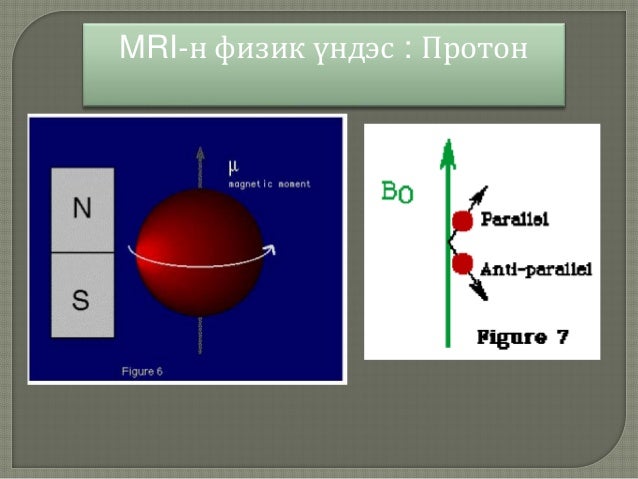 соронзон резонаст томографи
