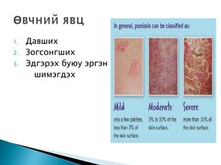 хайрс үлд | PPT