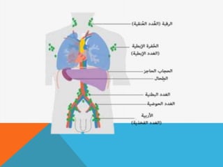 اورام الغدد الليمفاوية