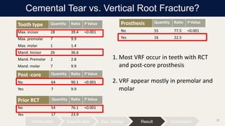 Max Molar Rct The Predispose Factor, Clinical Characteristics and Treatment Outcome ...