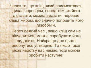 Через те, що кліщ, який присмоктався,
дихає черевцем, перед тим, як його
діставати, можна змазати черевце
кліща жиром, що значно погіршить його
газообмін.
Через деякий час , якщо кліщ сам не
відчепиться, можна спробувати його
видалити. Найкраще для цього
звернутись у лікарню. Та якщо такої
можливості у вас немає, тоді можна
зробити наступне:
 