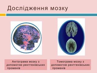 головний мозок