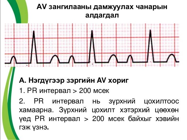 аг тэй холбоотой илрэх зцб-ийн бусад өөрчлөлтүүд
