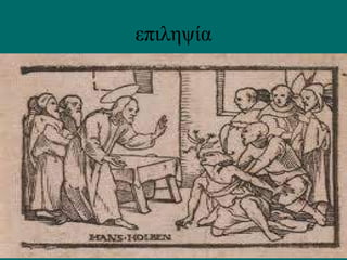 επιληψία
 