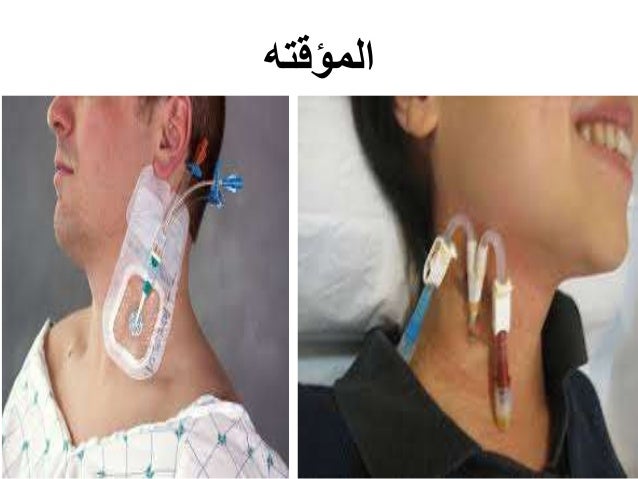 غسيل الكلى كيف يتم ومن يحتاجه Youtube