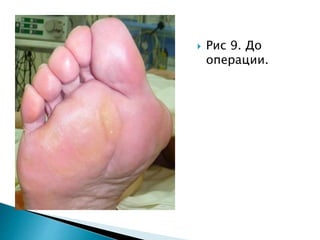  Рис 9. До
операции.
 
