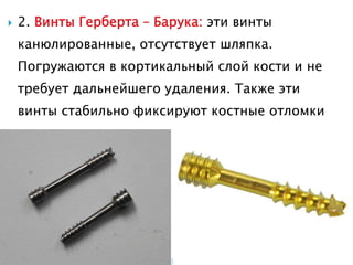  2. Винты Герберта – Барука: эти винты
канюлированные, отсутствует шляпка.
Погружаются в кортикальный слой кости и не
требует дальнейшего удаления. Также эти
винты стабильно фиксируют костные отломки
 
