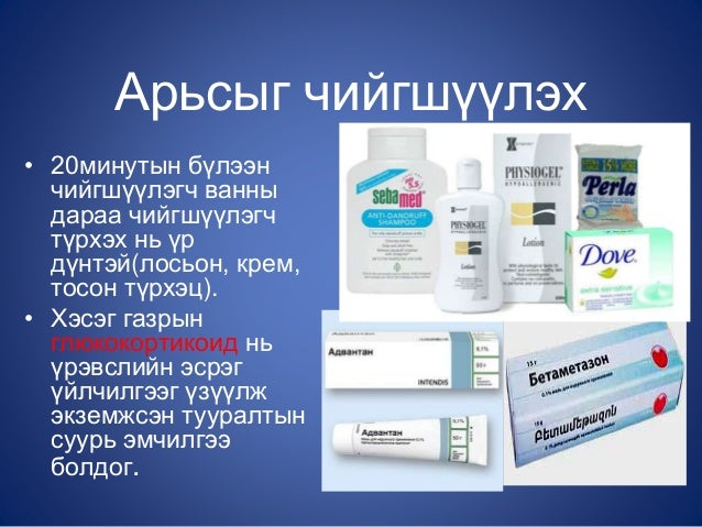 атопийн дерматит