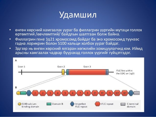 атопийн дерматит