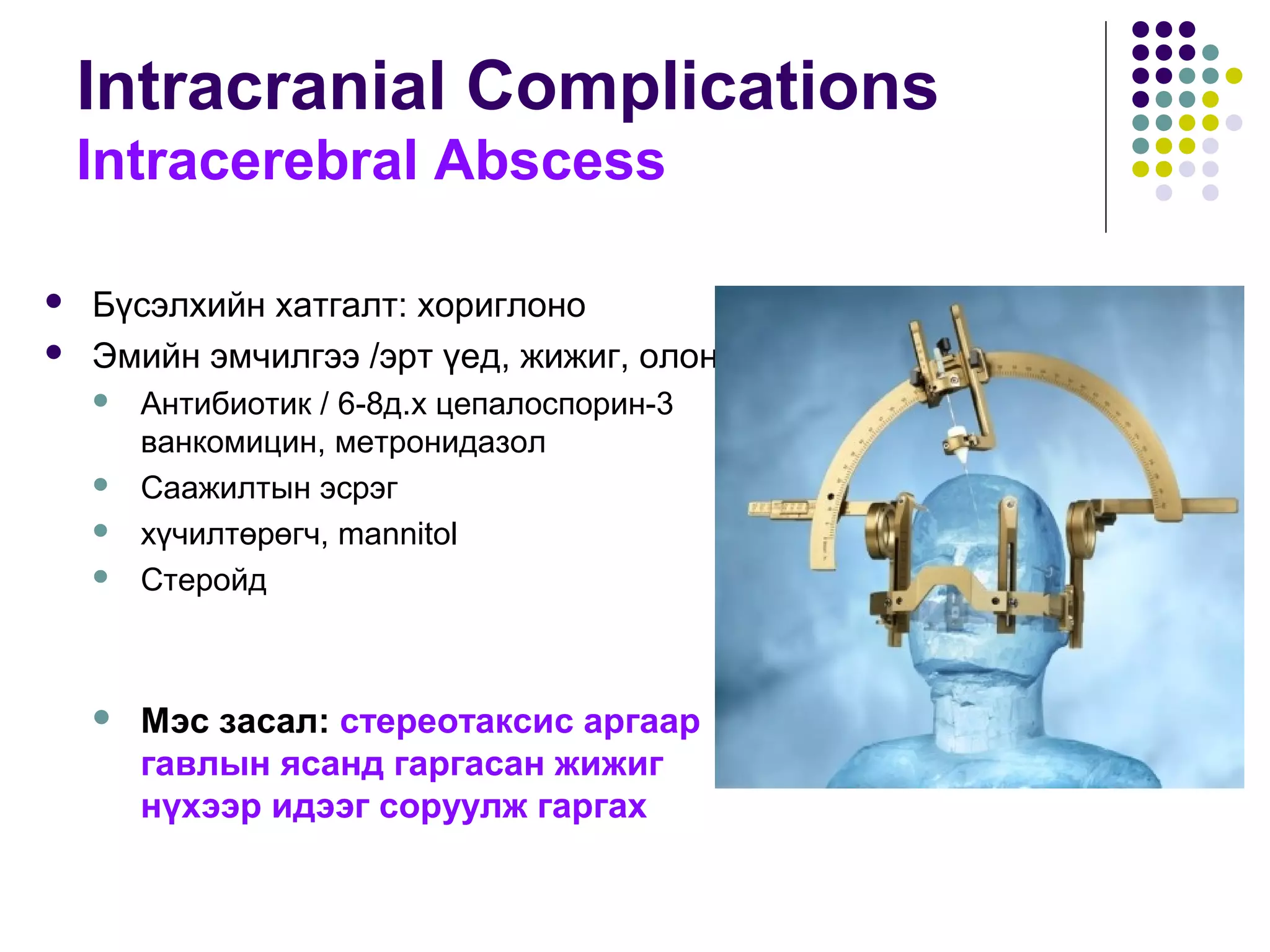 Intracranial Complications
Intracerebral Abscess
 Бүсэлхийн хатгалт: хориглоно
 Эмийн эмчилгээ /эрт үед, жижиг, олон/
 Антибиотик / 6-8д.х цепалоспорин-3
ванкомицин, метронидазол
 Саажилтын эсрэг
 хүчилтөрөгч, mannitol
 Стеройд
 Мэс засал: стереотаксис аргаар
гавлын ясанд гаргасан жижиг
нүхээр идээг соруулж гаргах
 