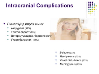 Intracranial Complications
 Seizure (31%)
 Hemiparesis (23%)
 Visual disturbance (23%)
 Meningismus (23%)
 Эмнэлзүйд илрэх шинж:
 халууралт (92%)
 Толгой өвдөлт (85%)
 Дотор муухайрах, бөөлжих (62%)
 Ухаан балартах (31%)
 