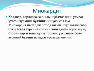 Миокардит
 Халдвар, хордлого, харшлын үйлчлэлийн улмаас
үүссэн зүрхний булчингийн үоэьсэл юм.
Миокардит нь халдвар хордлогын шууд нөлөөгөөр
буюу эсвэл зүрхний булчингийн эдийн эсрэг шууд
бус замаар аутоиммуны процесс үүссэнээс болж
зүрхний булчин нэмтдэг үрэвсэлт өвчин.
 
