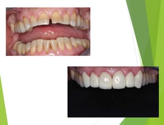 Презентация Хасаулов А.С.