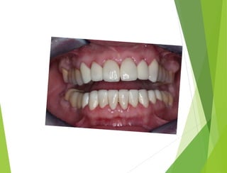 Презентация Хасаулов А.С.