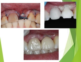 Презентация Хасаулов А.С.