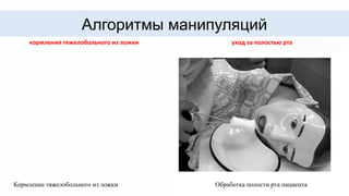 Алгоритмы манипуляций
кормления тяжелобольного из ложки
Кормление тяжелобольного из ложки
уход за полостью рта
Обработка полости рта пациента
 