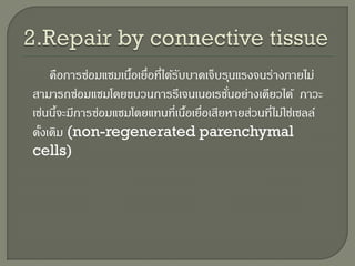 รูป: immediate hypersensitivity
 