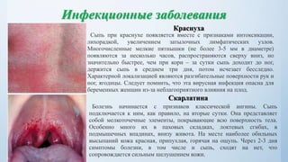 Дифференциальная диагностика сыпи у детей. Судорожный синдром | PPT