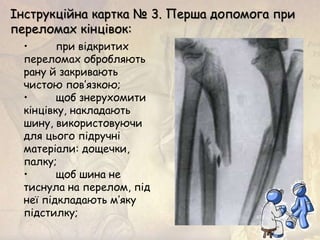 • при відкритих
переломах обробляють
рану й закривають
чистою пов’язкою;
• щоб знерухомити
кінцівку, накладають
шину, використовуючи
для цього підручні
матеріали: дощечки,
палку;
• щоб шина не
тиснула на перелом, під
неї підкладають м’яку
підстилку;
Інструкційна картка № 3. Перша допомога при
переломах кінцівок:
 