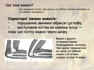 Характерні ознаки вивихів:
• порушення звичних обрисів суглоба;
• виступання кістки на новому місці —
іноді цю кістку видно через шкіру.
Що таке вивих?
(Це зміщення кісток, при якому суглобова головка виходить із
суглобової западини.)
Вивих є досить
складним видом
пошкодження, оскільки
при цьому порушується
не лише суглобний
мішок, а й зв’язки,
судини, а іноді й нерви.
 