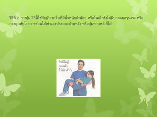 วิธีที่ 2 การอุ้ม วิธีนี้ ใช้กับผู้บาดเจ็บที่มีน้าหนักตัวน้อย หรือในเด็กซึ่งไม่มีบาดแผลรุนแรง หรือ
กระดูกหักโดยการช้อนใต้เข่าและประคองด้านหลัง หรืออุ้มทาบหลังก็ได้
 