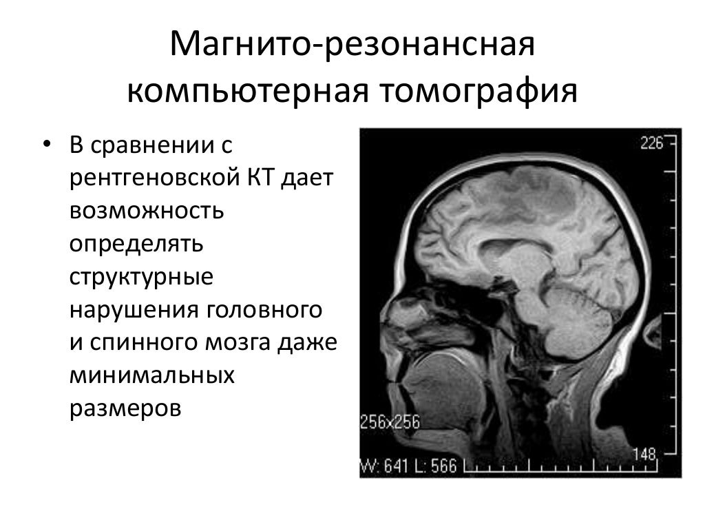 Неврология