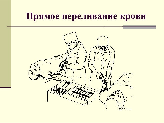 Прямое Переливание Крови Видео