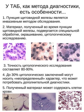 Тонкоигольная аспирационная пункционная биопсия щитовидной железы | PDF