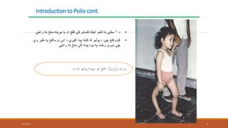 Introduction to Polio cont.
2/7/2017 4
•‫د‬۱‫ت‬ ‫منځ‬ ‫مړينه‬ ‫يا‬ ‫او‬ ‫فلج‬ ‫کې‬ ‫کسانو‬ ‫اخته‬ ‫کمو‬ ‫نه‬ ‫سلنې‬‫راځي‬ ‫ه‬
•‫فلج‬ ‫نرم‬ ‫انې‬ ‫د‬ ‫کيږي‬ ‫پيدا‬ ‫کبله‬ ‫له‬ ‫پوليو‬ ‫د‬ ‫چې‬ ‫فلج‬ ‫کوم‬‫وي‬ ‫څير‬ ‫په‬
‫راځي‬ ‫ته‬ ‫منځ‬ ‫کې‬ ‫پښه‬ ‫يوه‬ ‫په‬ ‫وخت‬ ‫ډيری‬ ‫چي‬
‫ولرئ‬ ‫ياد‬ ‫په‬!‫ده‬ ‫نه‬ ‫پوليو‬ ‫پيښه‬ ‫هر‬ ‫فلج‬ ‫د‬
 