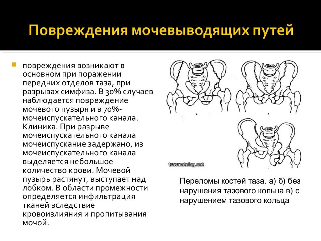 Осаго повреждение забора Осаго повреждение забора