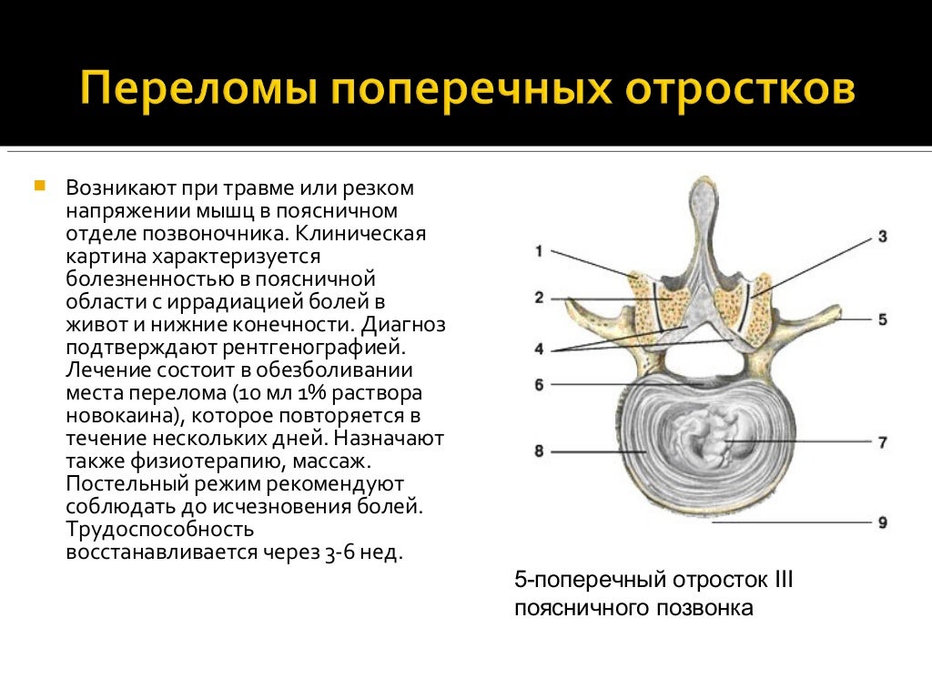 Задний бугорок поперечного отростка