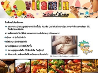 CR : https://cdn-images-1.medium.com/
 