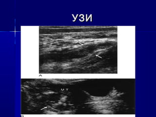 УЗИУЗИ
 